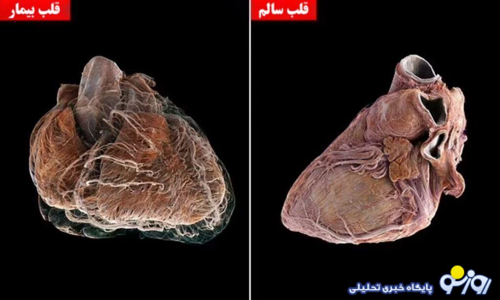 سفری شگفت‌انگیز به درون قلب انسان؛ تصویربرداری از قلب با جزئیاتی بی‌سابقه